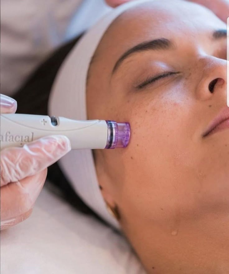 HYDRAFACIAL